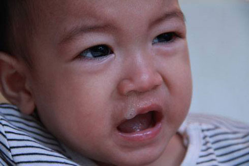 nguyên nhân trẻ ngẹt mũi
